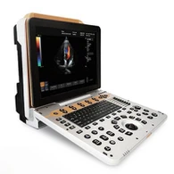 Bärbar 4D färgdoppler ultraljud